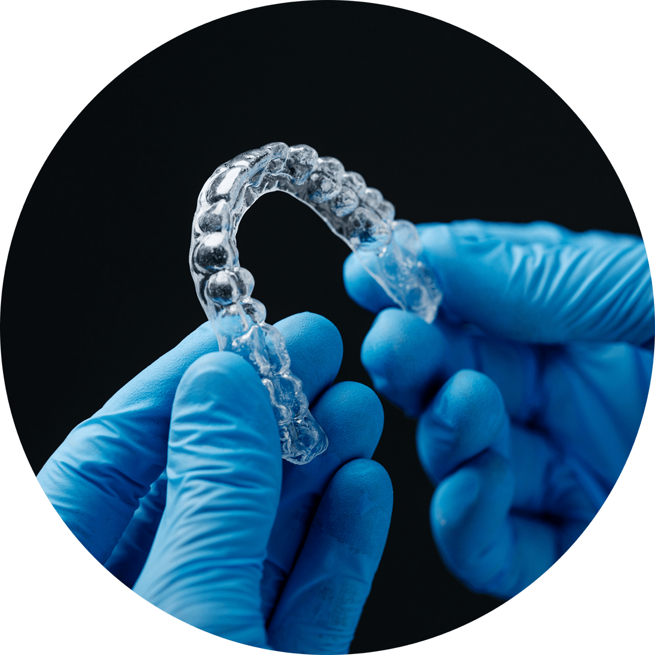 aligners - orthoclear