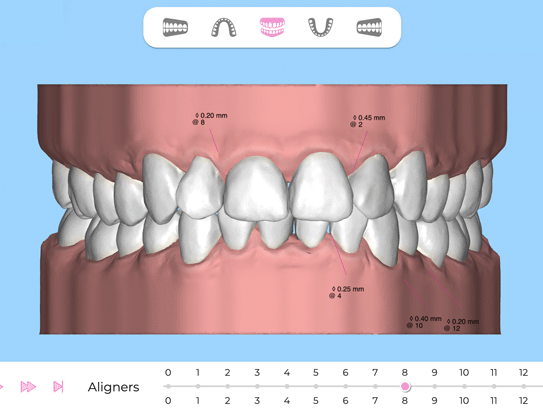 A render of interactive 3D teeth.